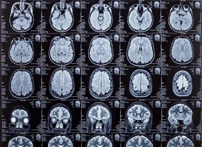 comparative data and reports for alzheimer's patients under hospice care service